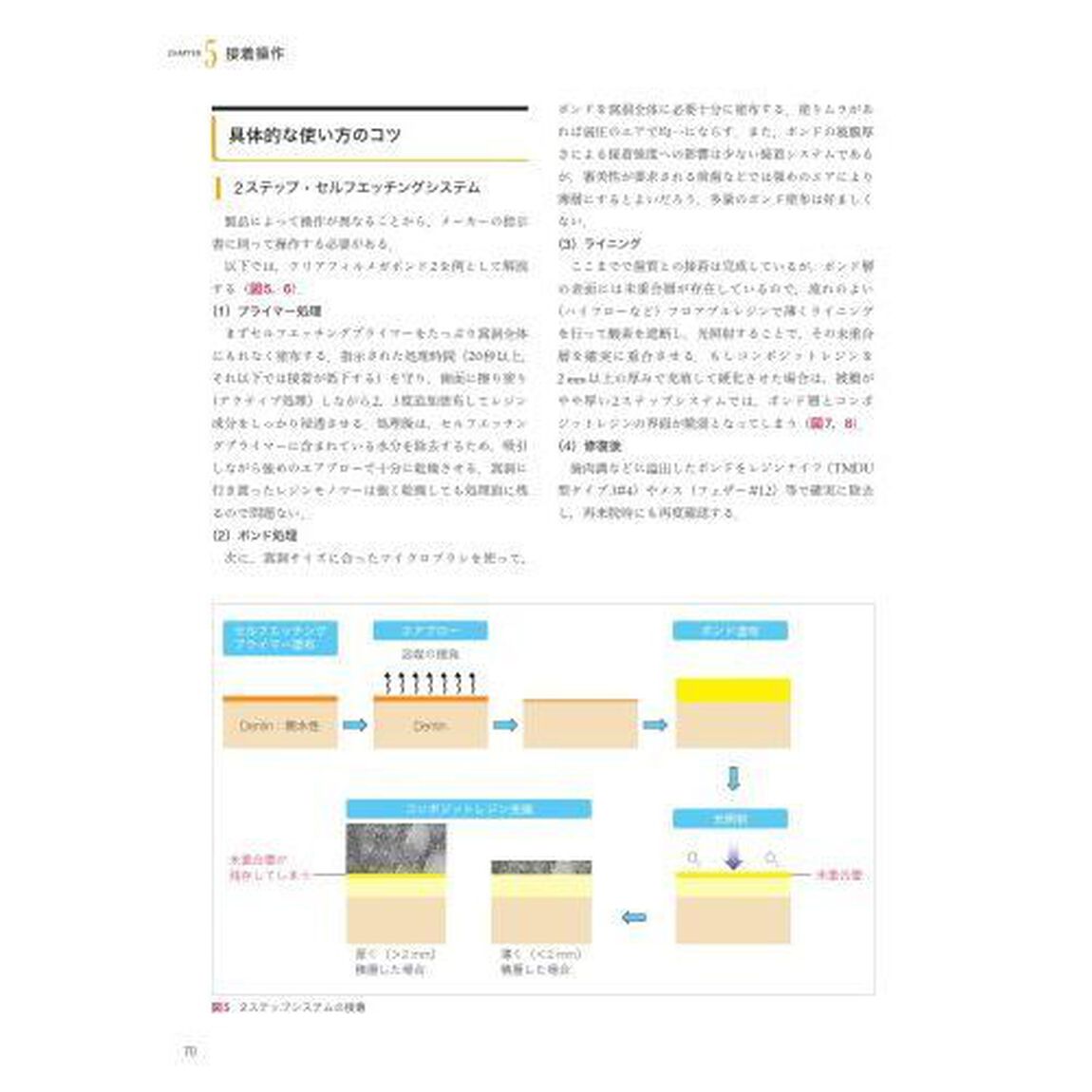 手に取るようにわかるコンポジットレジン修復のメソッド