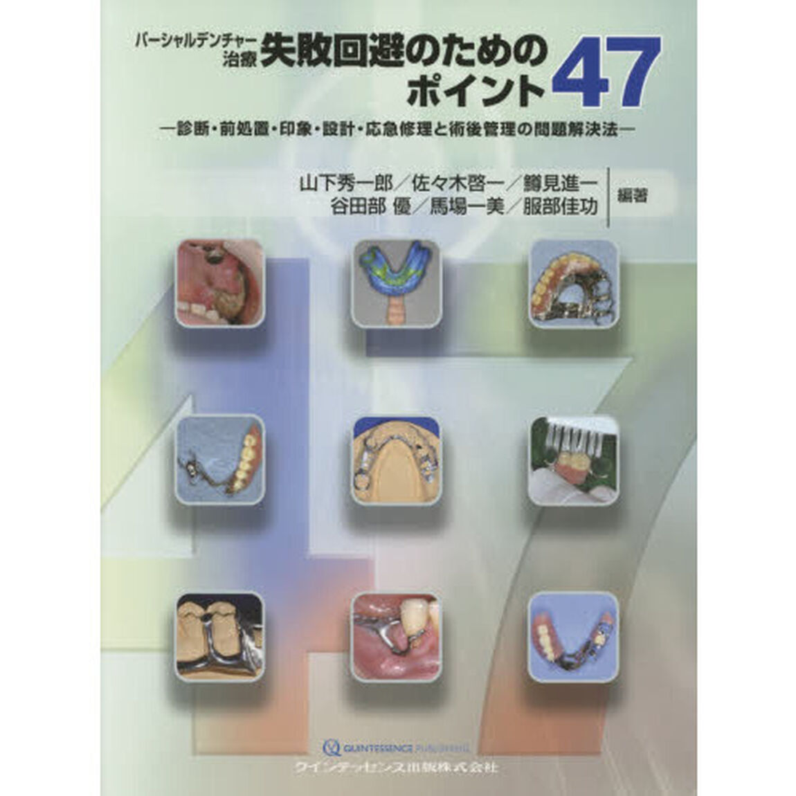 パーシャルデンチャー治療失敗回避のためのポイント４７　診断・前処置・印象・設計・応急修理と術後管理の問題解決法