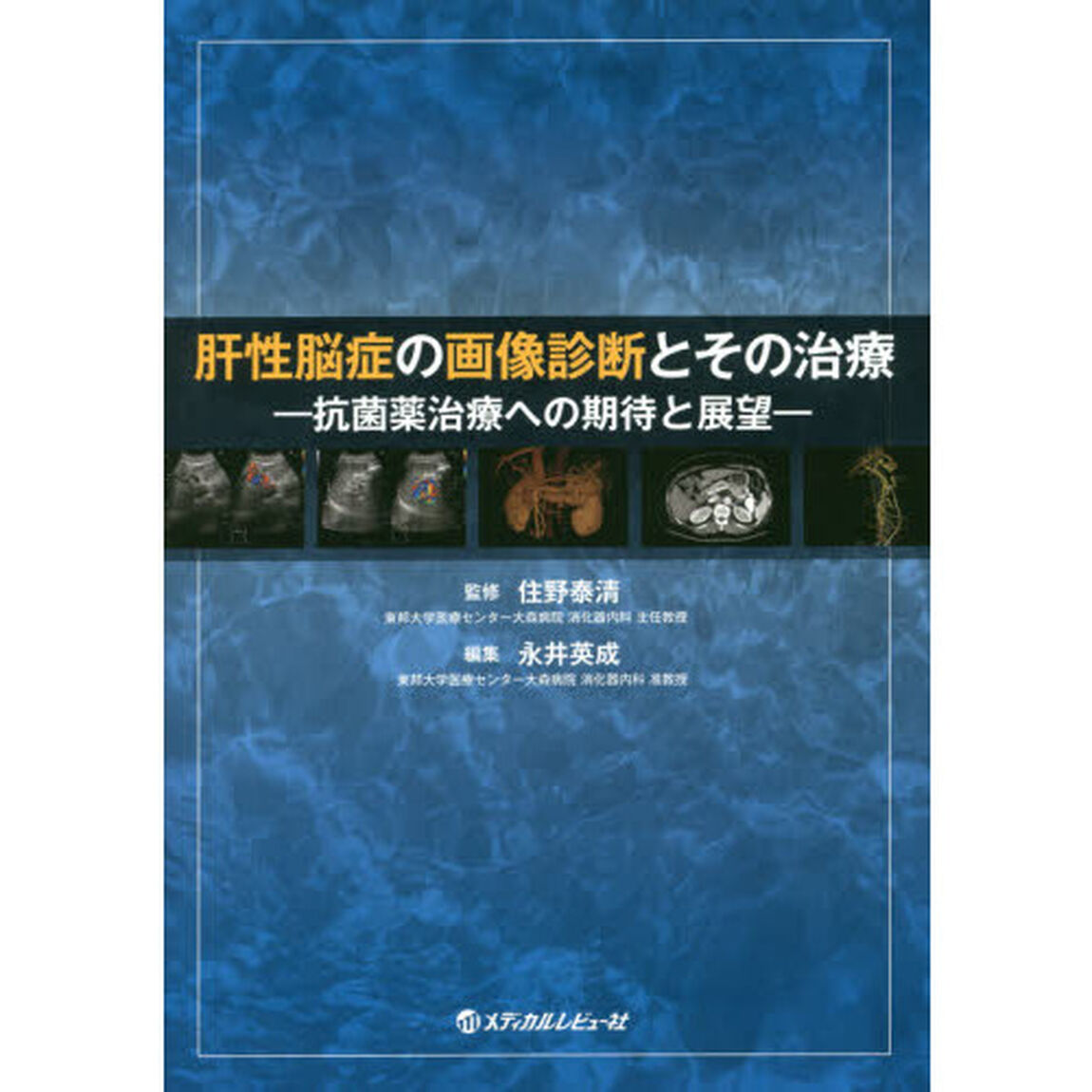 肝性脳症の画像診断とその治療　抗菌薬治療への期待と展望