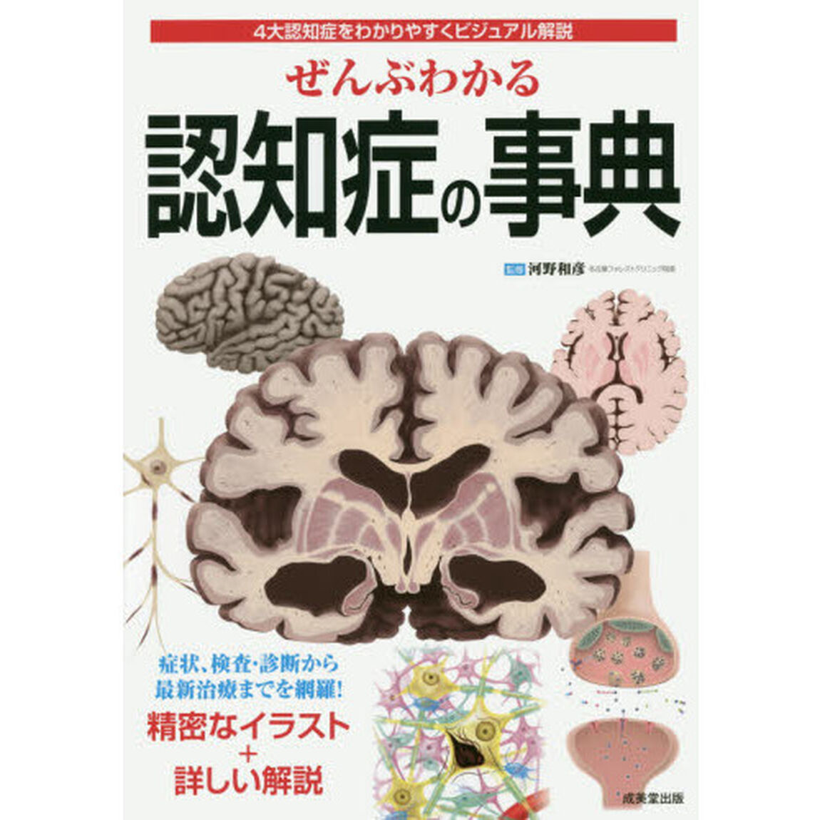 ぜんぶわかる認知症の事典　４大認知症をわかりやすくビジュアル解説