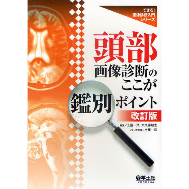 頭部画像診断のここが鑑別ポイント「改訂版」