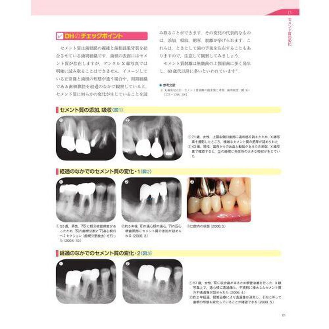 歯科衛生士のためのＸ線写真パーフェクトＢＯＯＫ　これでカンペキ！撮影補助＆臨床応用