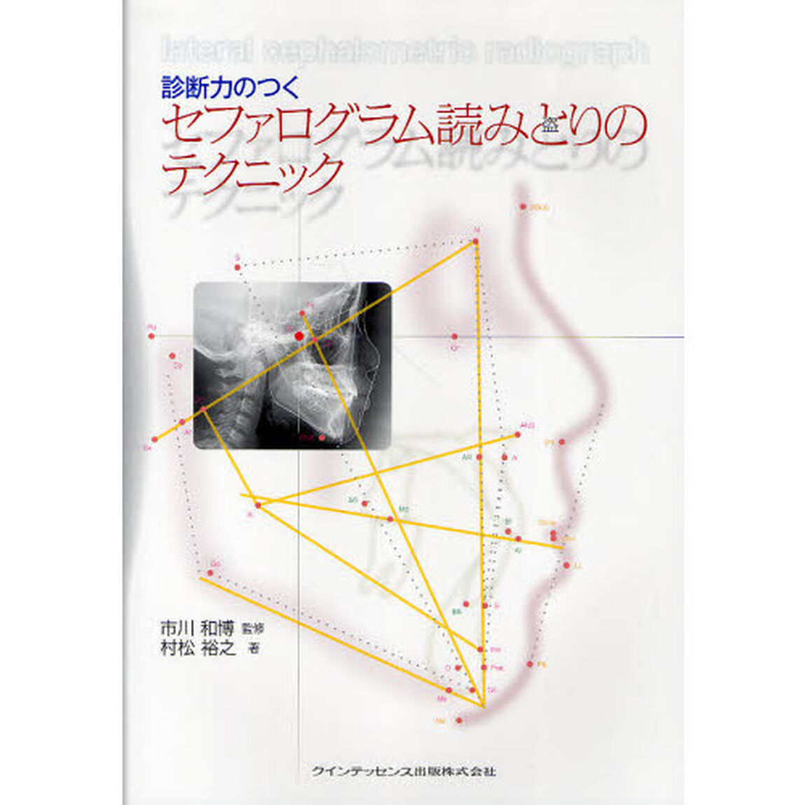 診断力のつくセファログラム読みとりのテクニック