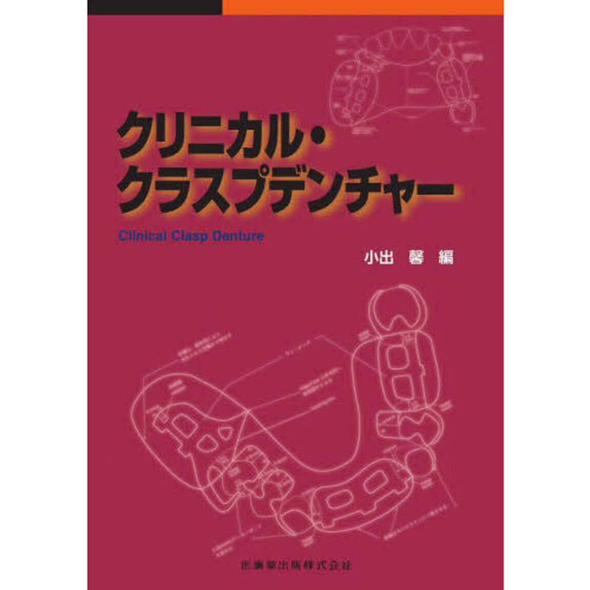 クリニカル・クラスプデンチャー