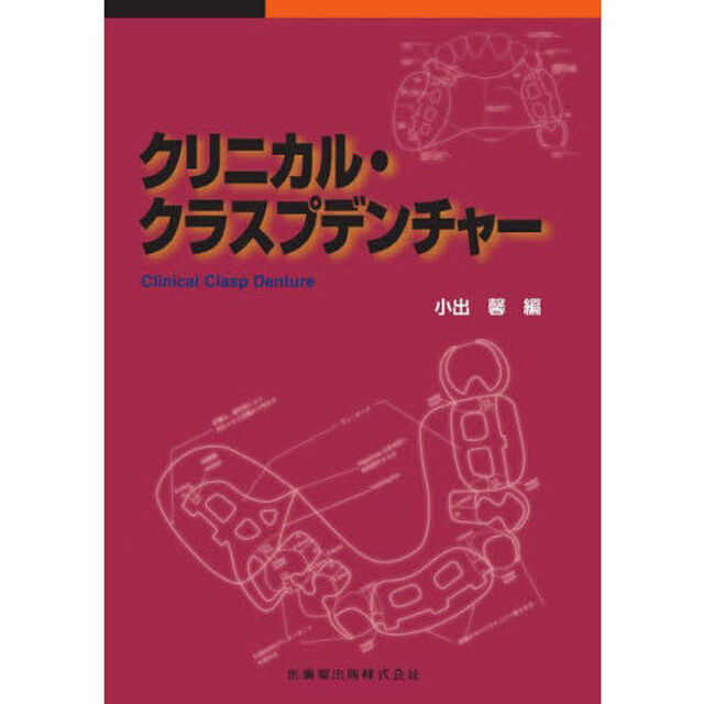 クリニカル・クラスプデンチャー