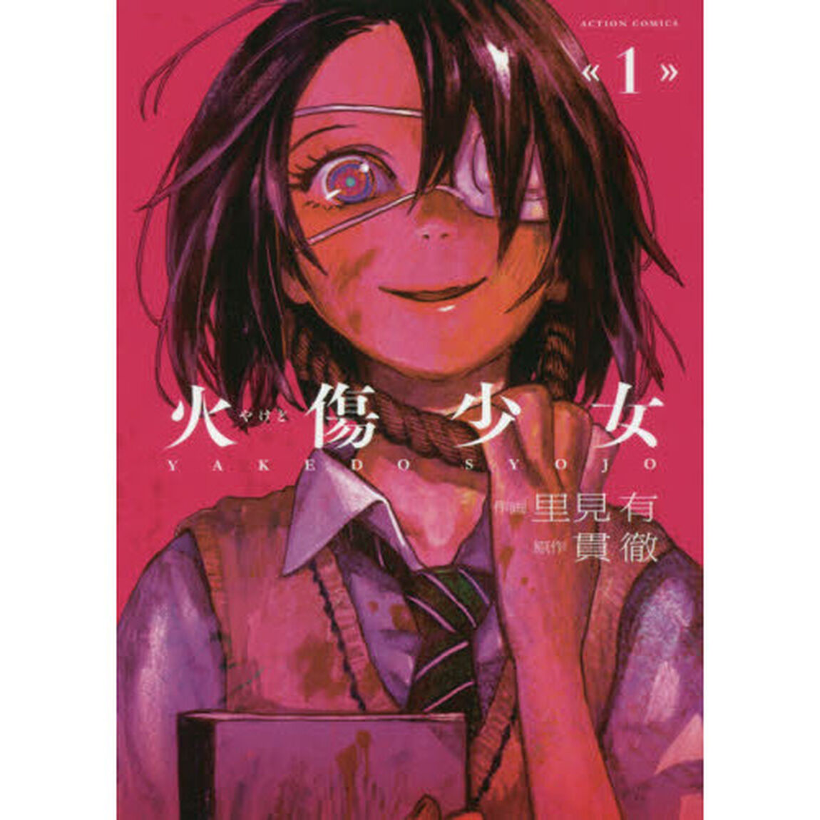 火傷少女　１