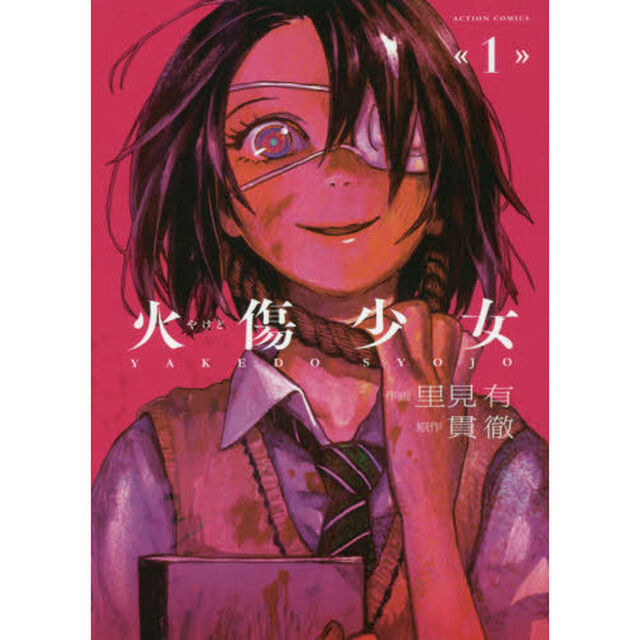 火傷少女　１