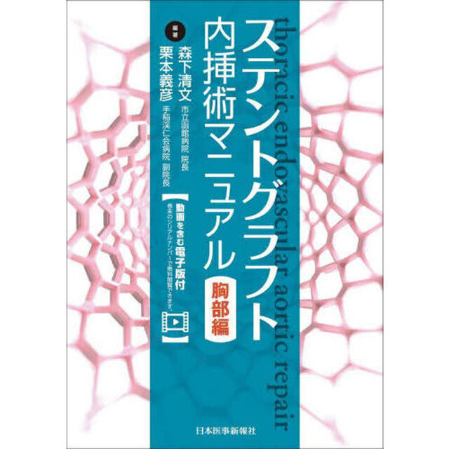 ステントグラフト内挿術マニュアル　胸部編