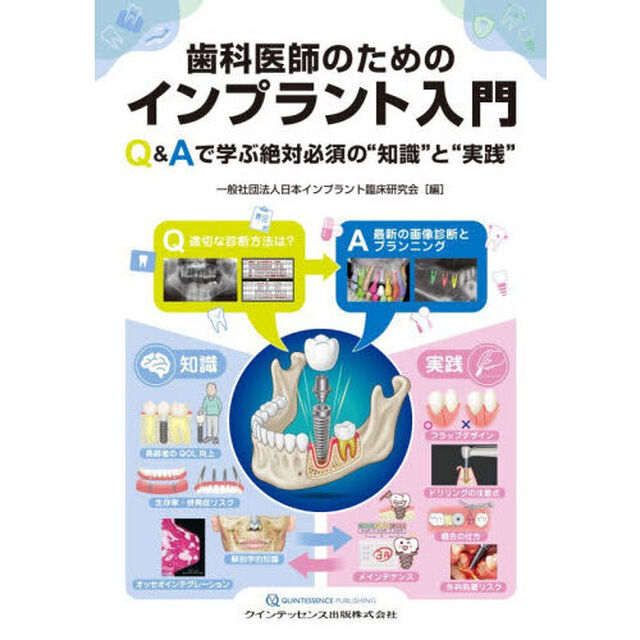 歯科医師のためのインプラント入門　Ｑ＆Ａで学ぶ絶対必須の&ldquo;知識&rdquo;と&ldquo;実践&rdquo;