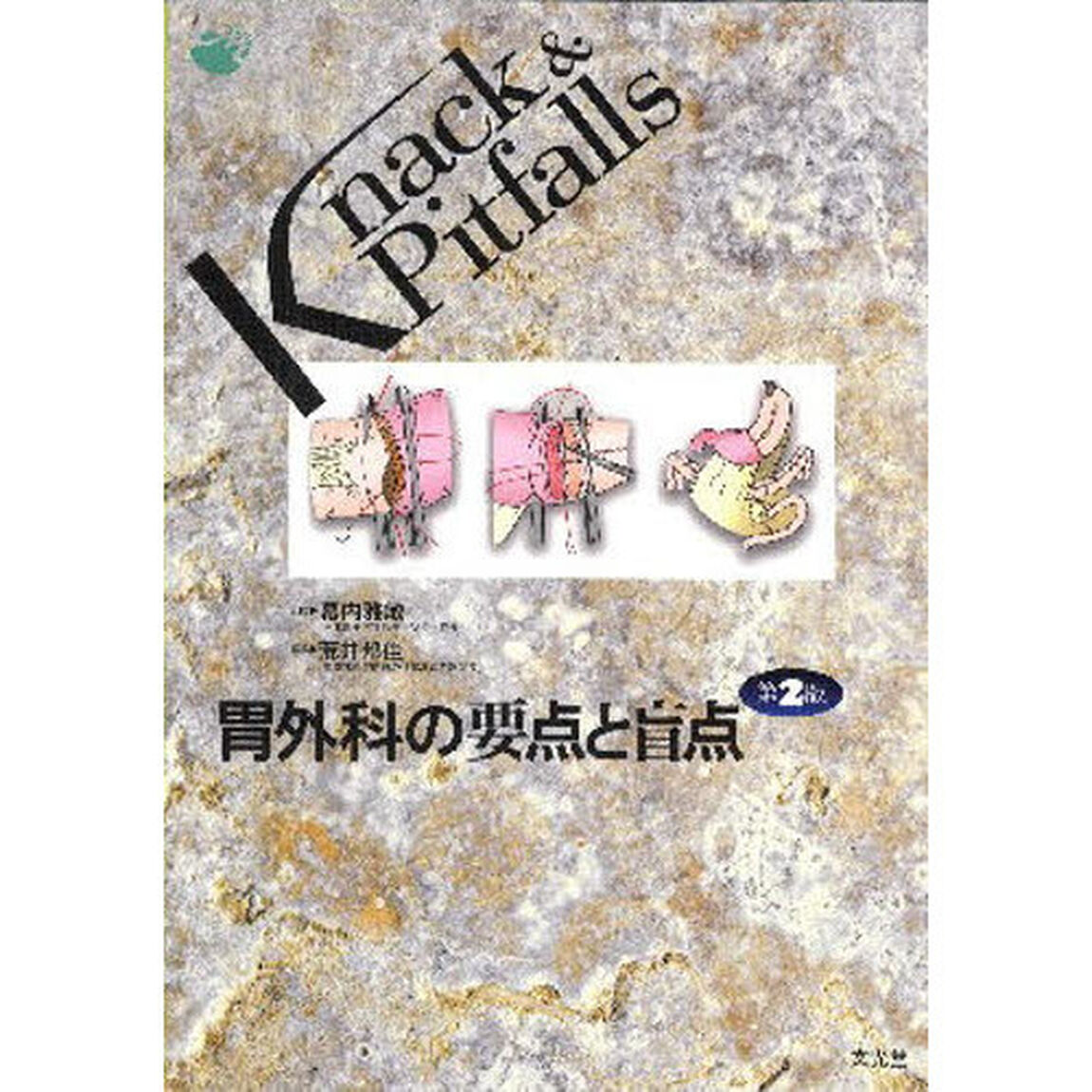 胃外科の要点と盲点「第２版」