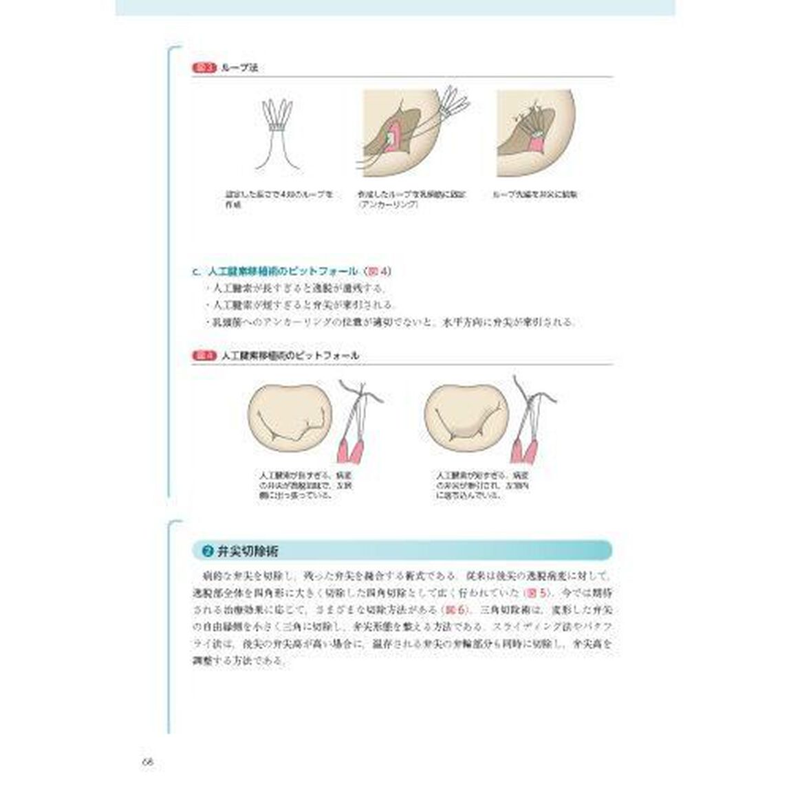 必携！術後心エコーガイドブック　術式イラストと実例から学ぶ評価のポイント