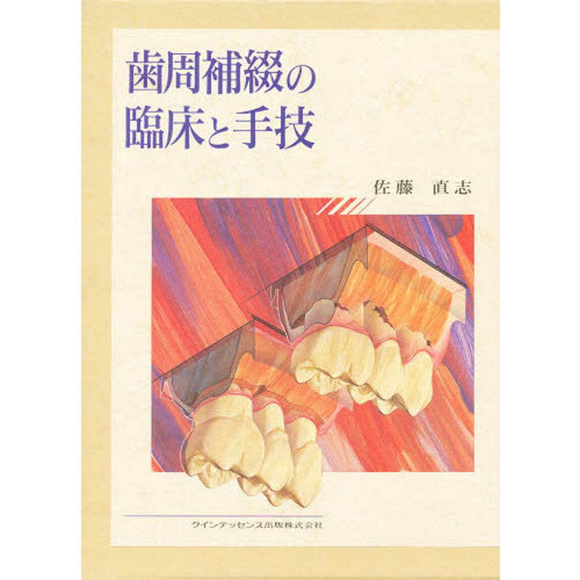 歯周補綴の臨床と手技