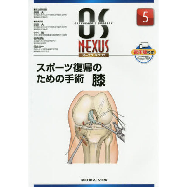 スポーツ復帰のための手術　膝