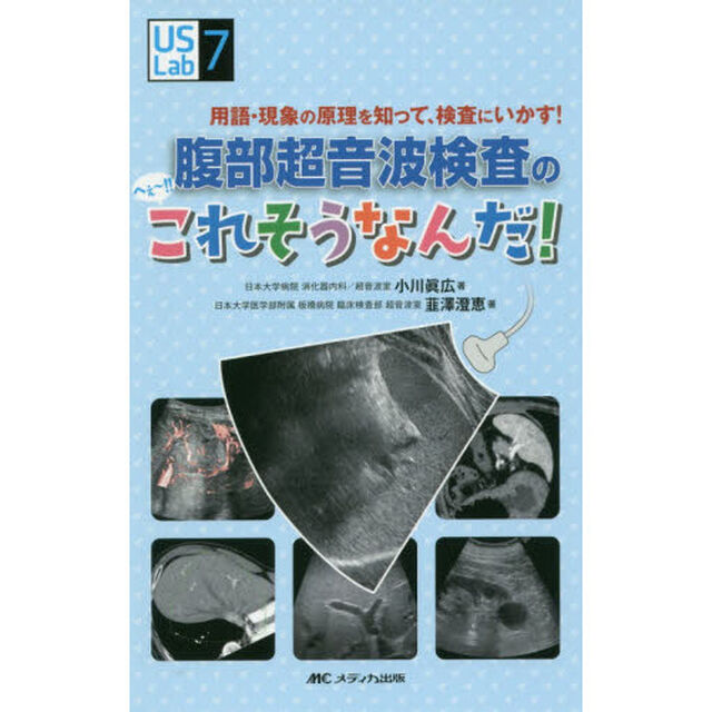 腹部超音波検査のへぇ〜！！これそうなんだ！　用語・現象の原理を知って、検査にいかす！