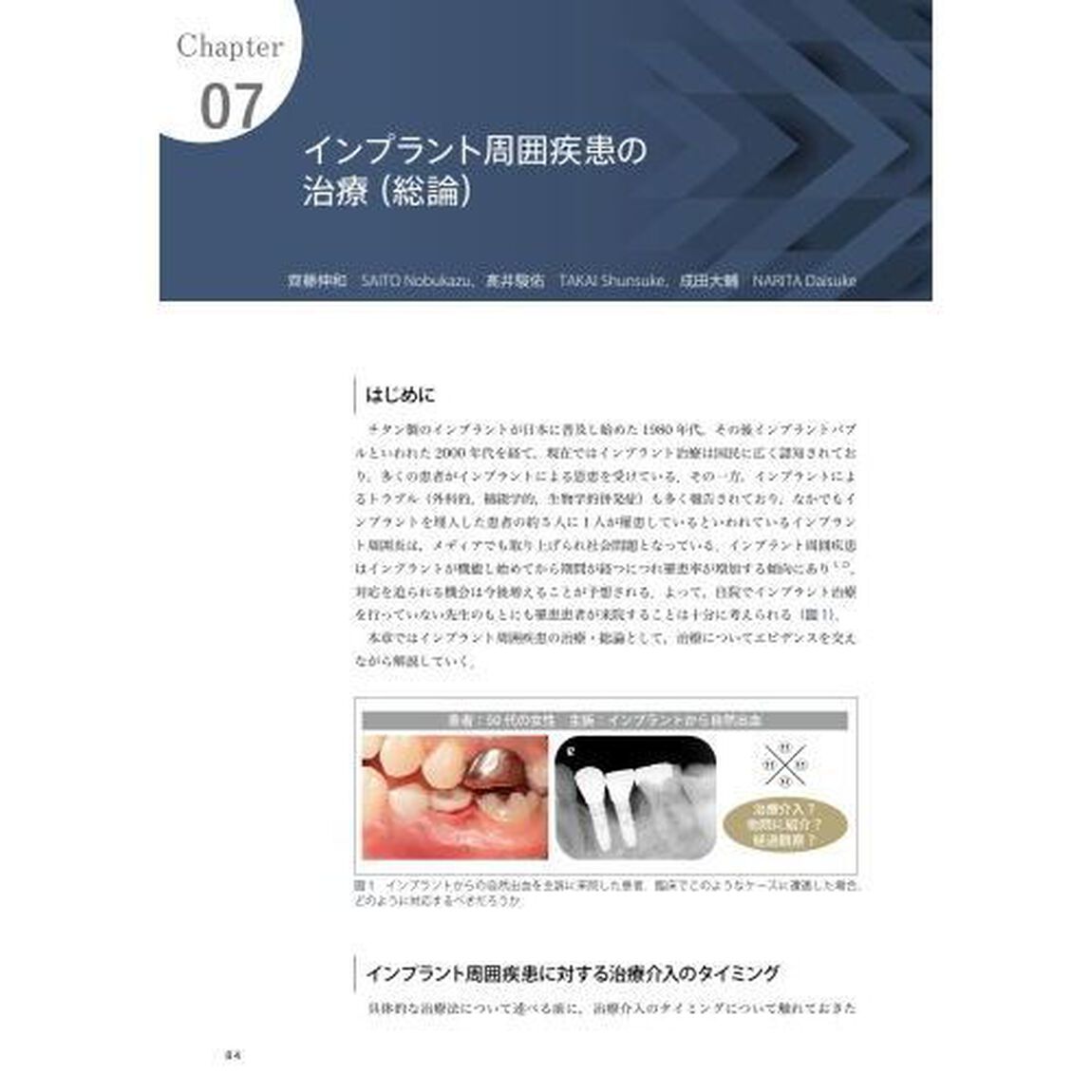 インプラント周囲疾患のすべて