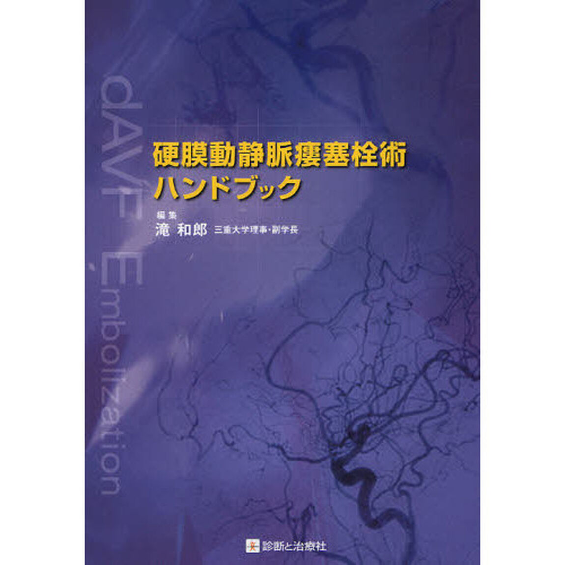 硬膜動静脈瘻塞栓術ハンドブック