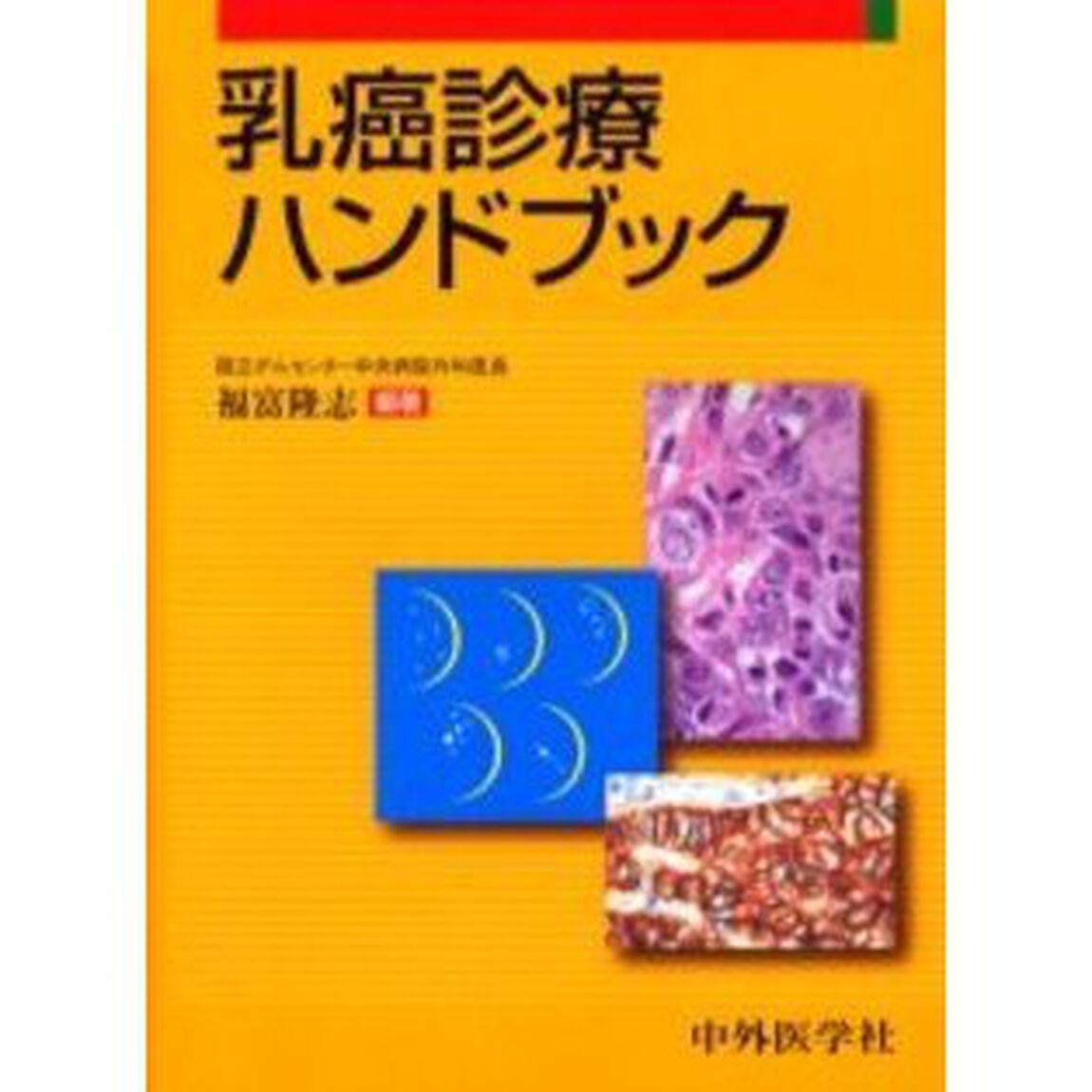 乳癌診療ハンドブック
