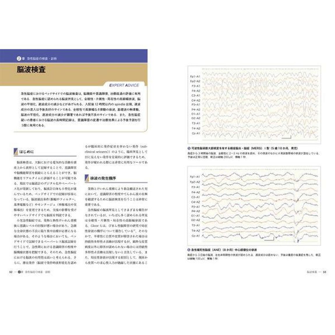 小児急性脳炎・脳症のとらえ方と治療戦略　Ｐｒａｃｔｉｃｅ　ａｎｄ　Ｐｒｏｇｒｅｓｓ