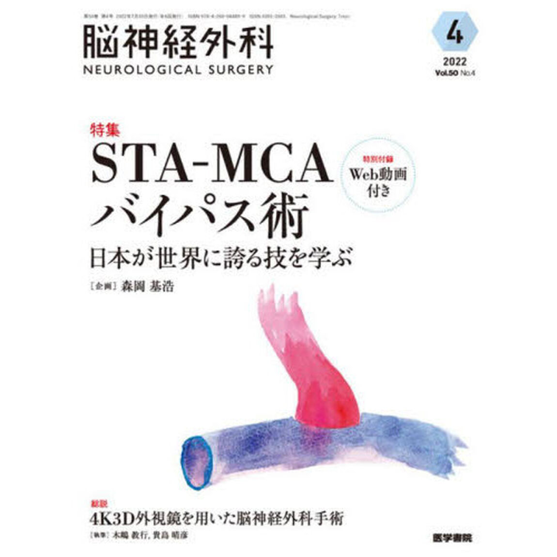 脳神経外科　Ｖｏｌ．５０Ｎｏ．４（２０２２－４）「特集ＳＴＡ－ＭＣＡバイパス術　日本が世界に誇る技を学ぶ」