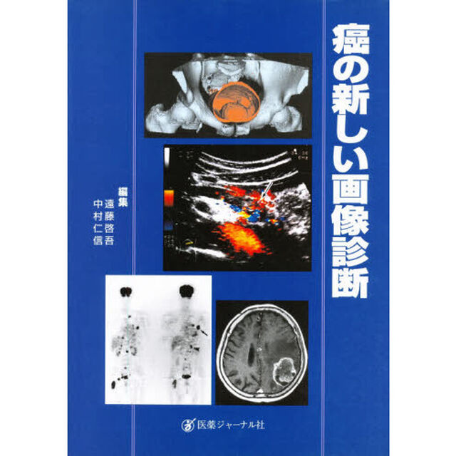 癌の新しい画像診断
