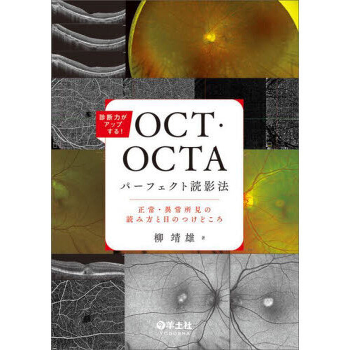 診断力がアップする！ＯＣＴ・ＯＣＴＡパーフェクト読影法　正常・異常所見の読み方と目のつけどころ