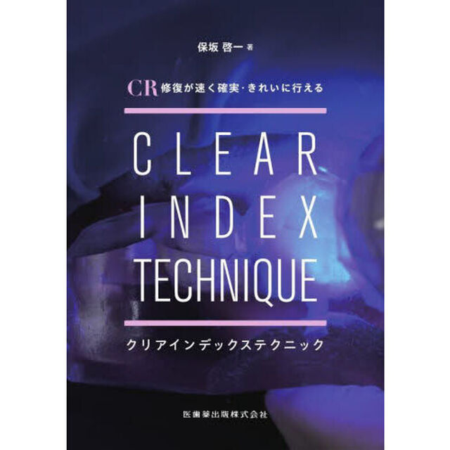 ＣＲ修復が速く確実・きれいに行えるクリアインデックステクニック