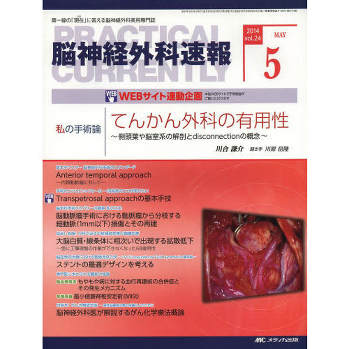 脳神経外科速報　第２４巻５号（２０１４－５）「私の手術論　川合謙介「てんかん外科の有用性〜側頭葉や脳室系の解剖とｄｉｓｃｏｎｎｅｃｔｉｏｎの概念〜」」