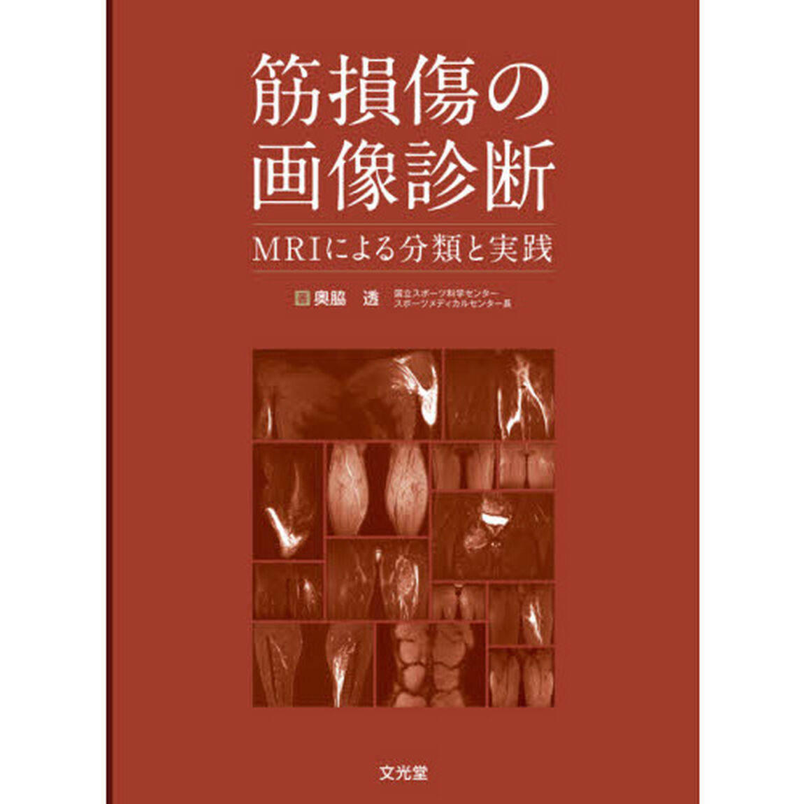 筋損傷の画像診断　ＭＲＩによる分類と実践