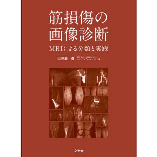 筋損傷の画像診断　ＭＲＩによる分類と実践