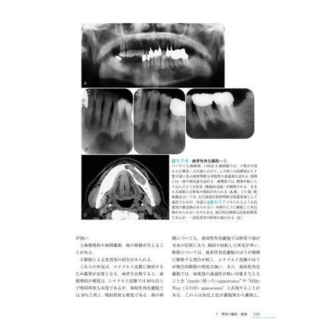 歯科放射線学「第７版」