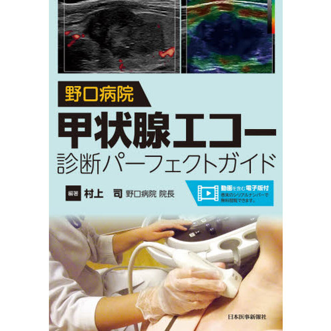 野口病院甲状腺エコー診断パーフェクトガイド