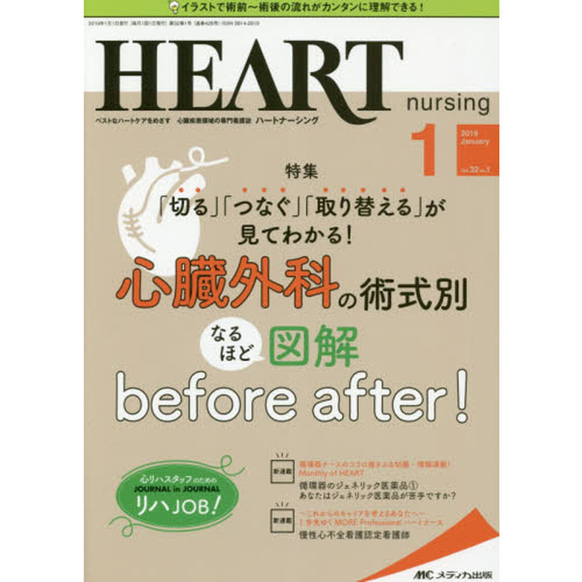 ハートナーシング　ベストなハートケアをめざす心臓疾患領域の専門看護誌　第３２巻１号（２０１９－１）「心臓外科の術式別なるほど図解ｂｅｆｏｒｅ　ａｆｔｅｒ！」