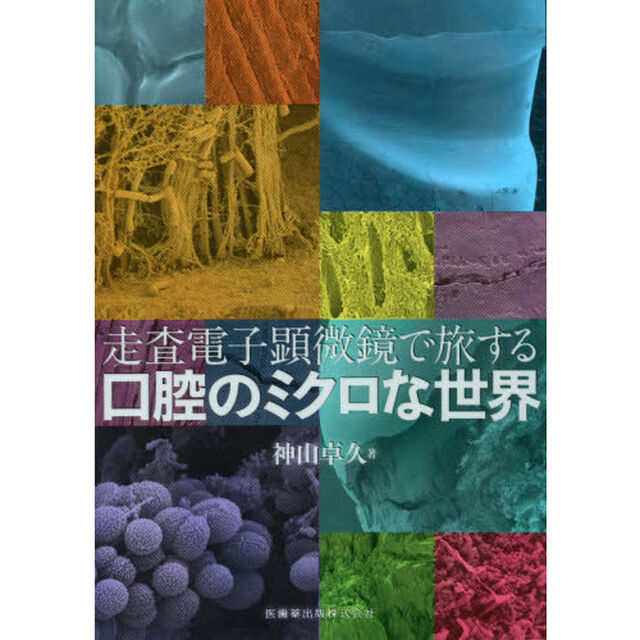 走査電子顕微鏡で旅する口腔のミクロな世界