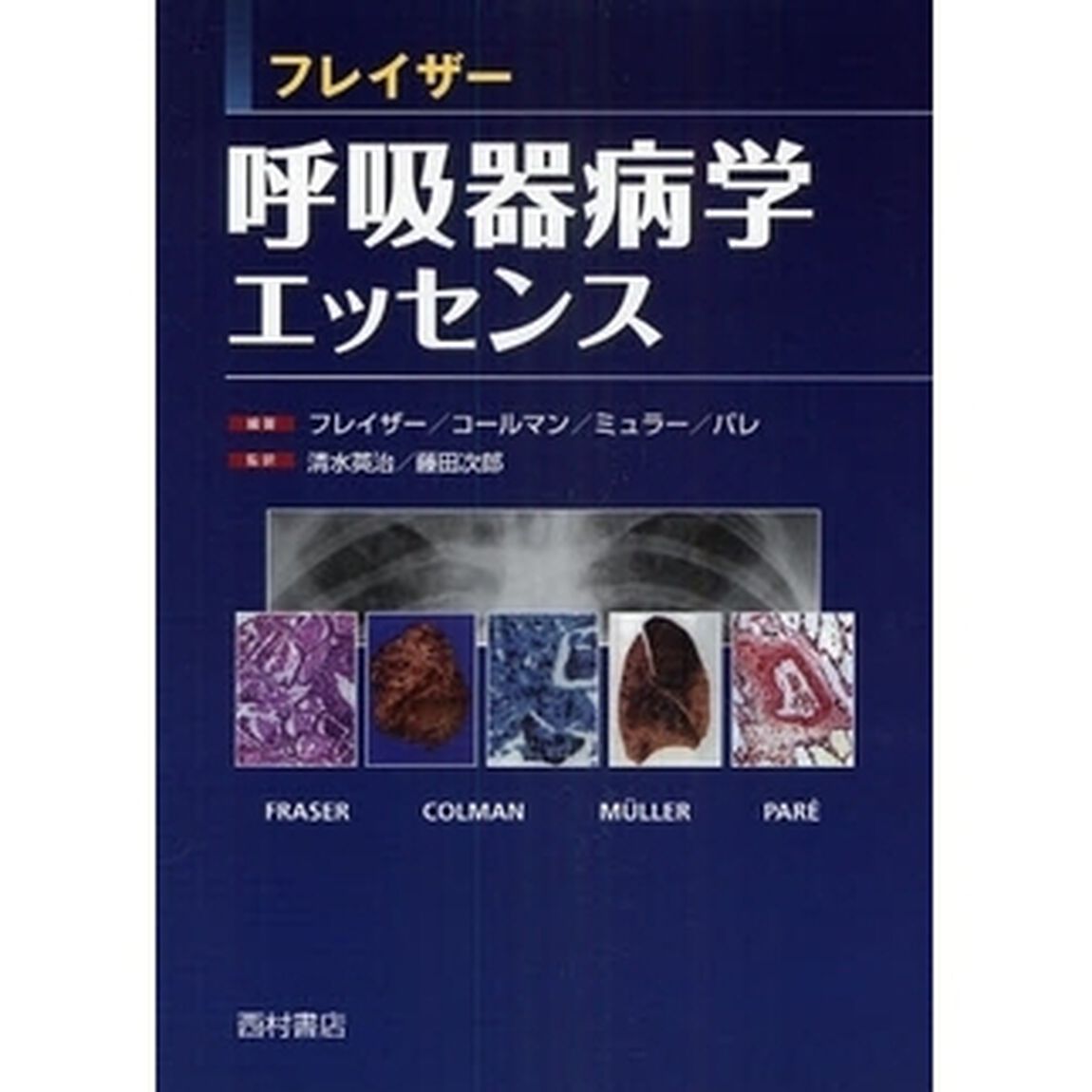フレイザー呼吸器病学エッセンス