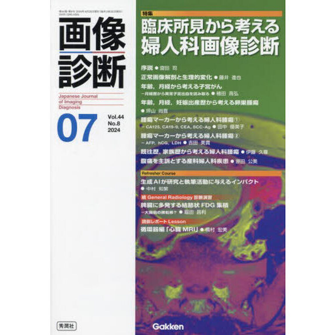 画像診断　Ｖｏｌ．４４Ｎｏ．８（２０２４年７月号）「特集臨床所見から考える婦人科画像診断」