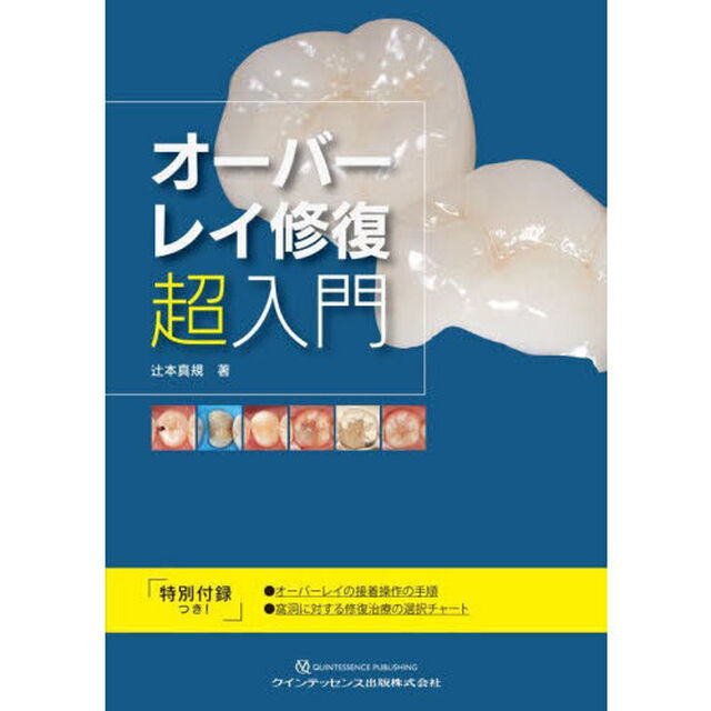 オーバーレイ修復超入門