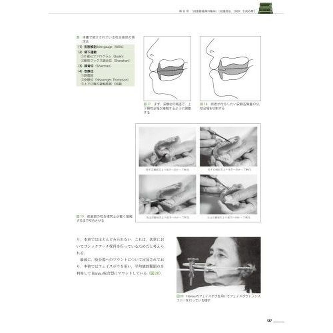 名著から学ぶ全部床義歯臨床　復古再生の治療コンセプト＆アプローチ