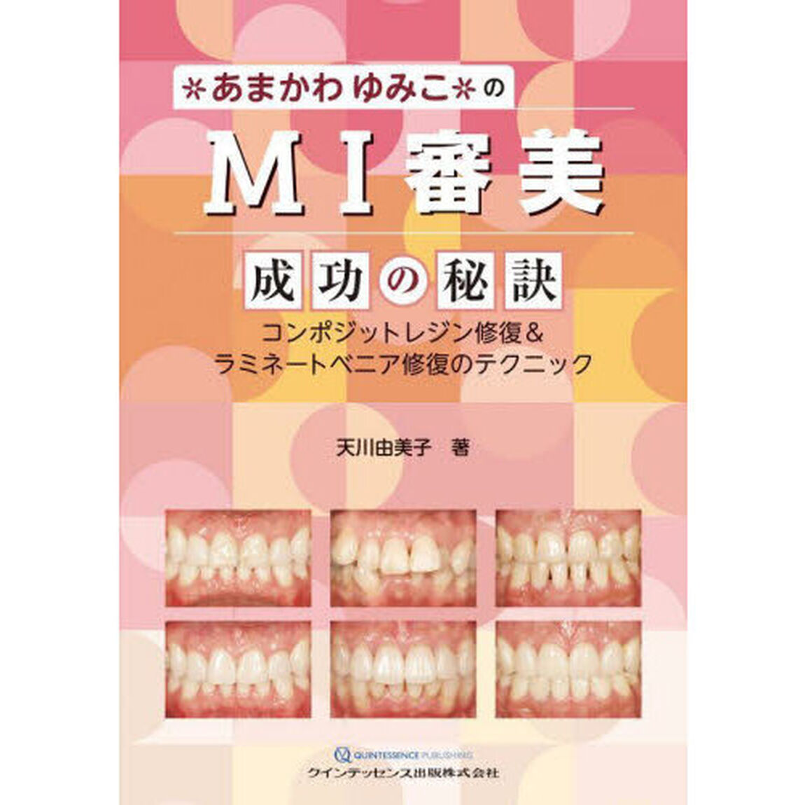 あまかわゆみこのＭＩ審美成功の秘訣　コンポジットレジン修復＆ラミネートベニア修復のテクニック