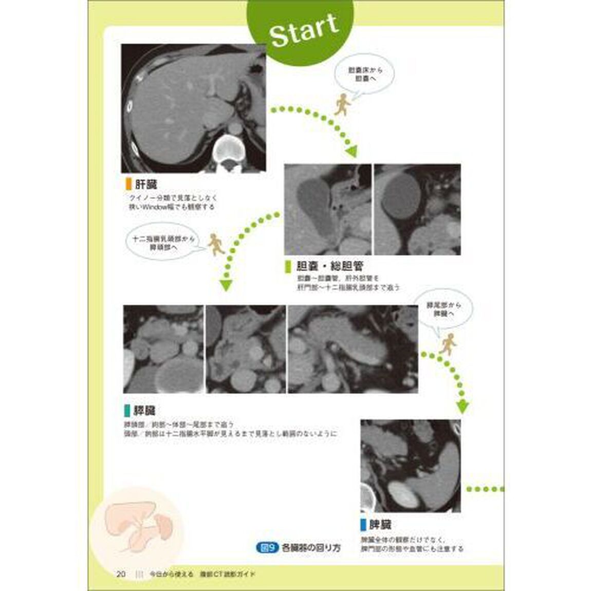 今日から使える腹部ＣＴ読影ガイド　異常所見を見逃さないための系統的読影法