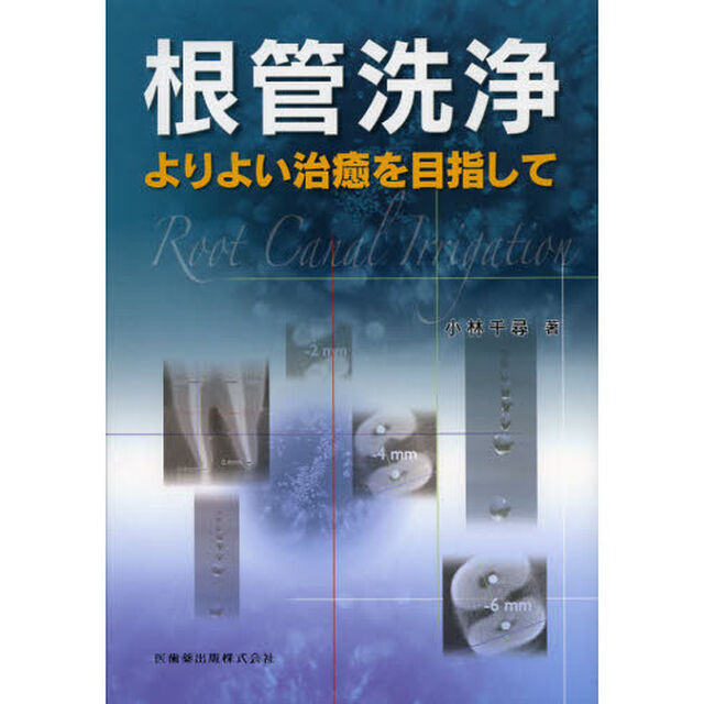 根管洗浄　よりよい治癒を目指して