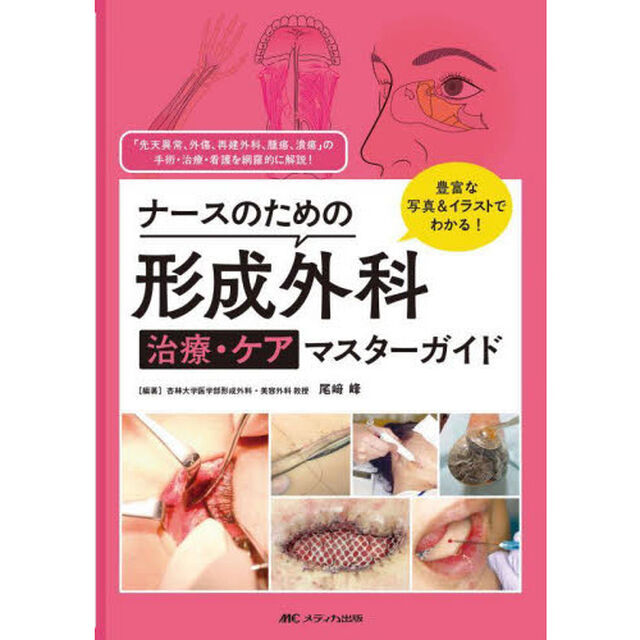 ナースのための形成外科治療・ケアマスターガイド　豊富な写真＆イラストでわかる！　「先天異常、外傷、再建外科、腫瘍、潰瘍」の手術・治療・看護を網羅的に解説！
