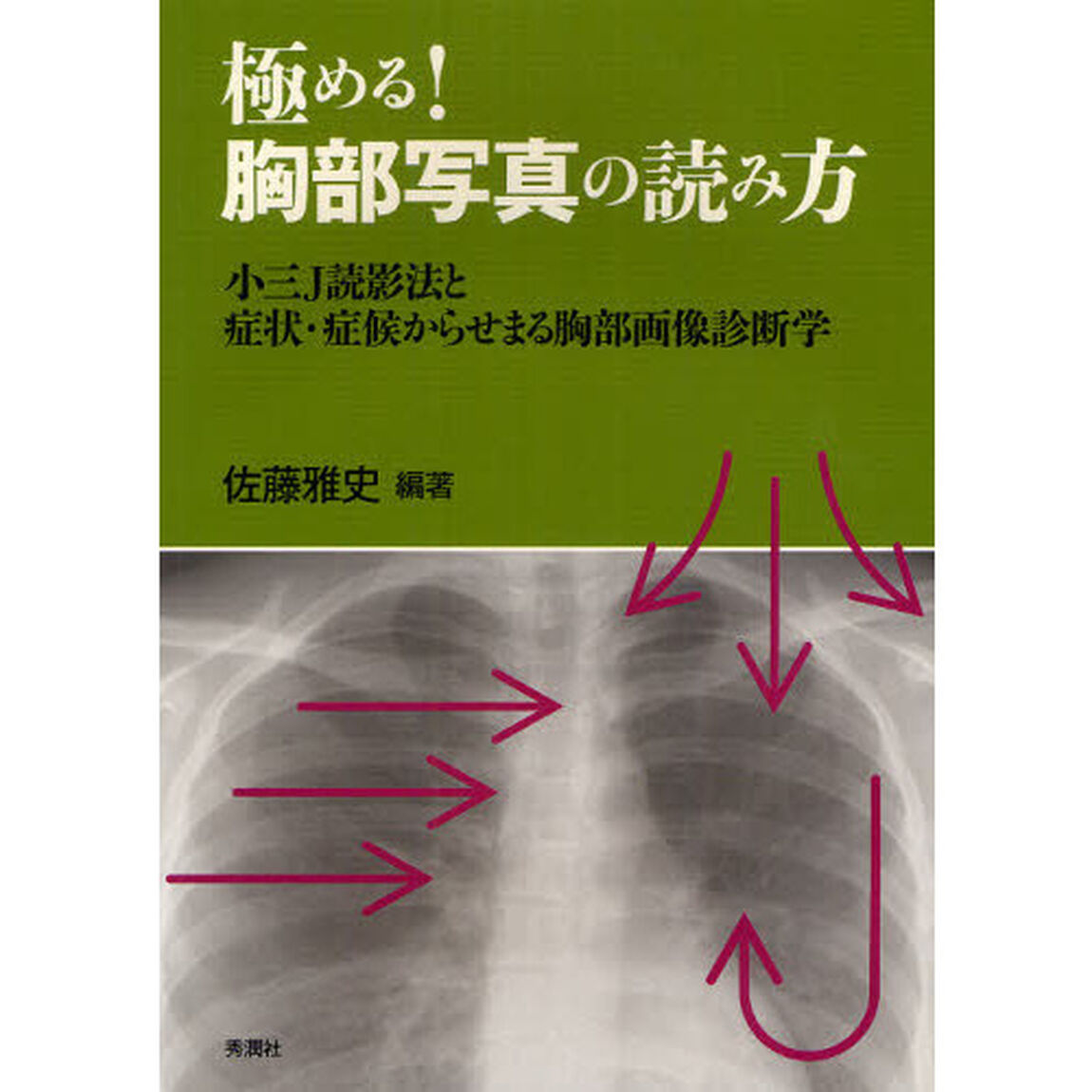 極める！胸部写真の読み方　小三Ｊ読影法と症状・症候からせまる胸部画像診断学