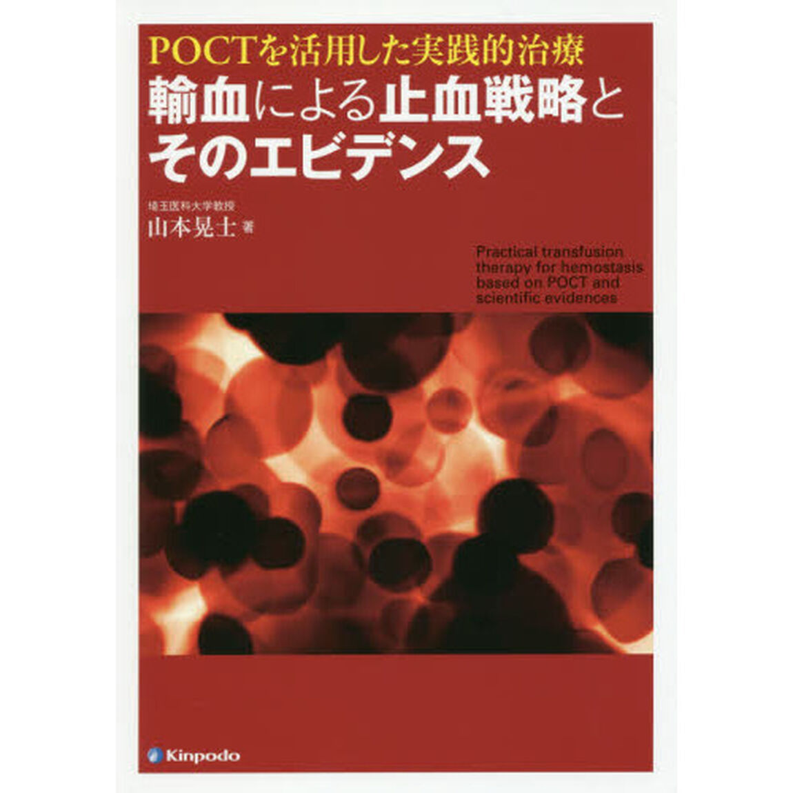 ＰＯＣＴを活用した実践的治療輸血による止血戦略とそのエビデンス