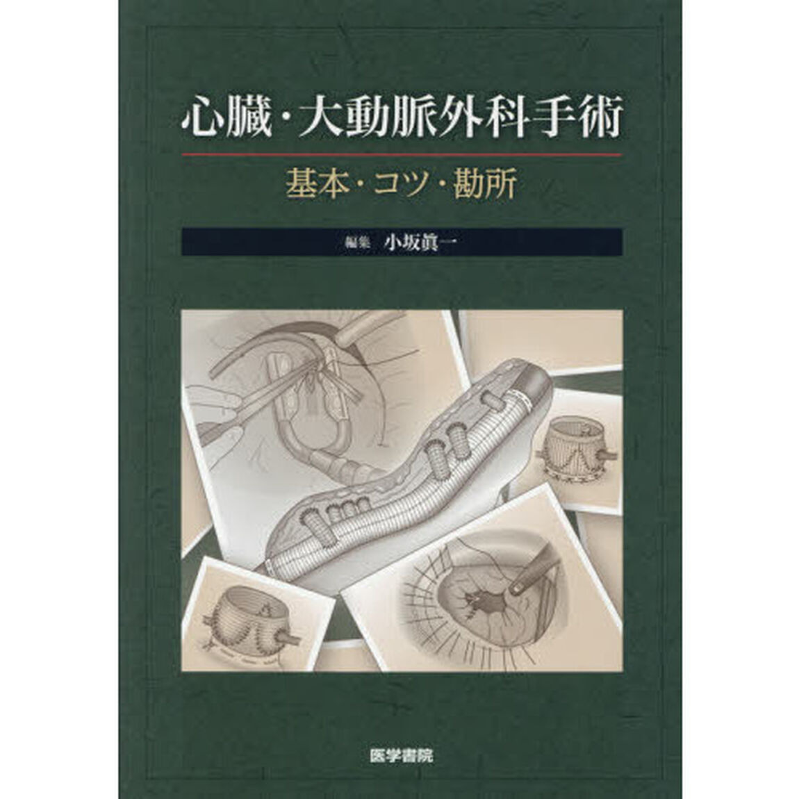 心臓・大動脈外科手術　基本・コツ・勘所