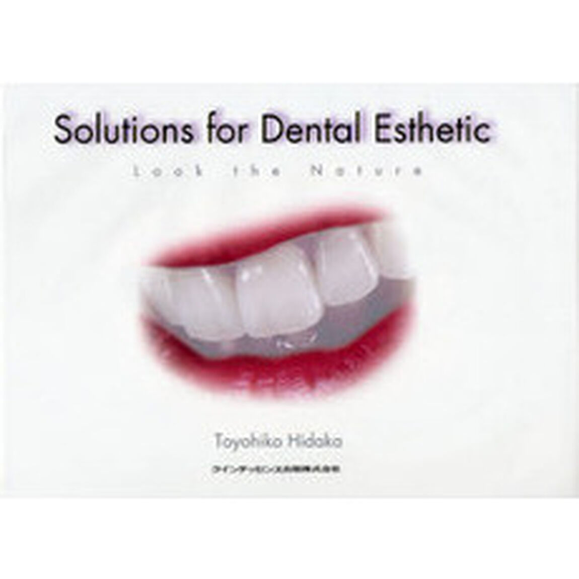 Ｓｏｌｕｔｉｏｎｓ　ｆｏｒ　Ｄｅｎｔａｌ　Ｅｓｔｈｅｔｉｃ　Ｌｏｏｋ　ｔｈｅ　Ｎａｔｕｒｅ