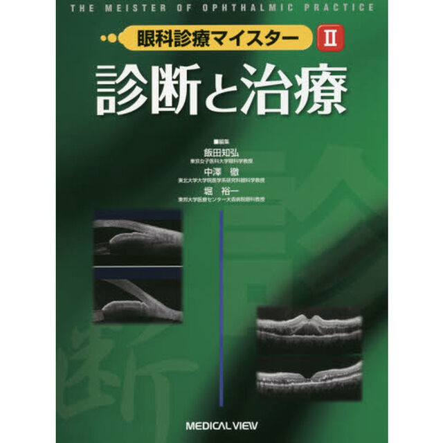 眼科診療マイスター　２「診断と治療」