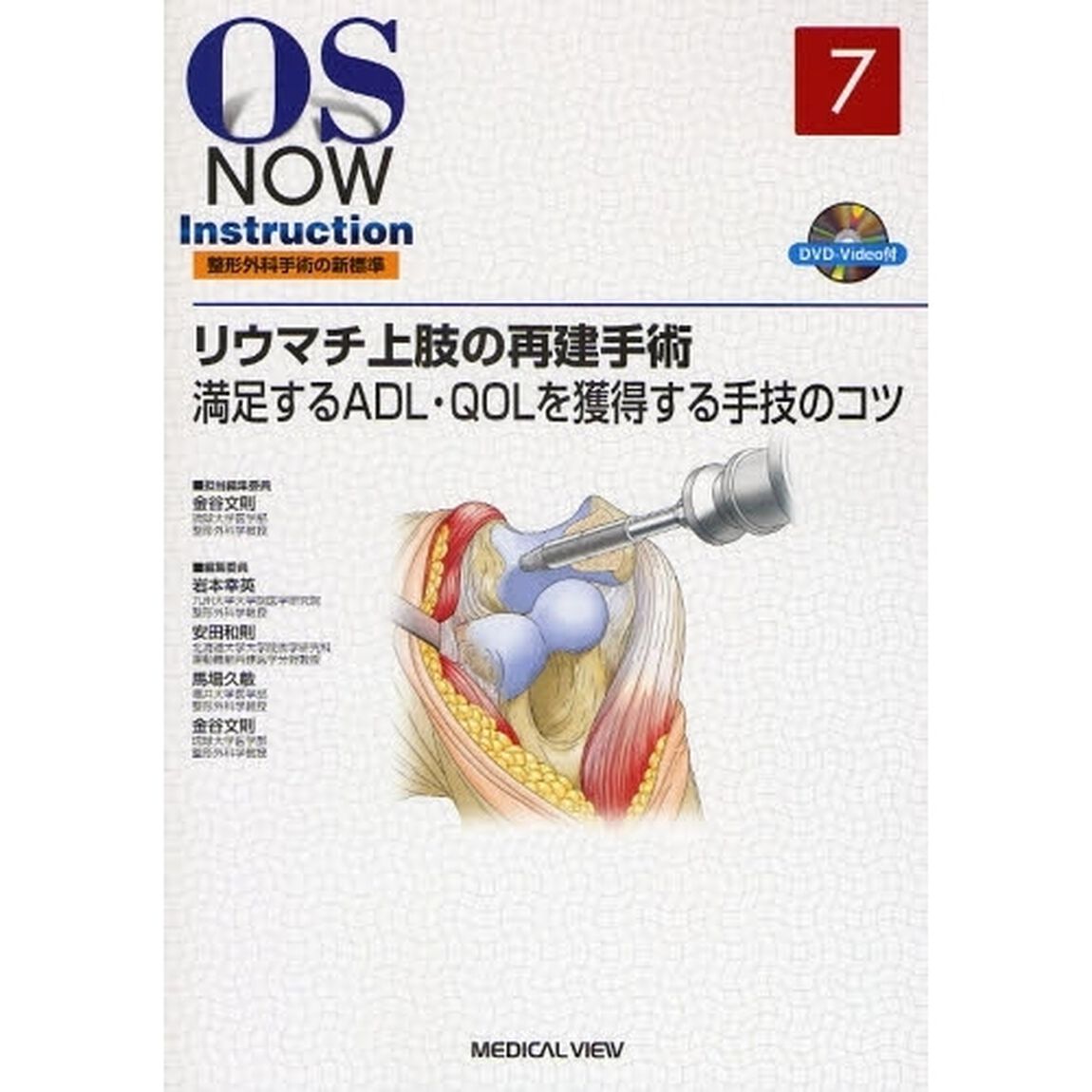 リウマチ上肢の再建手術　満足するＡＤＬ・ＱＯＬを獲得する手技のコツ
