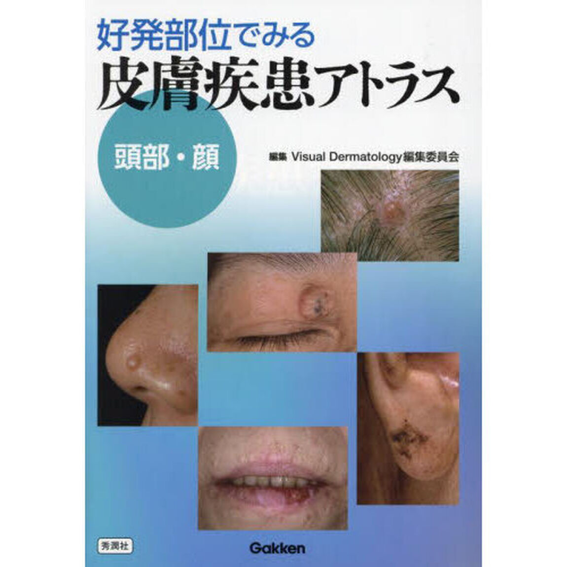 好発部位でみる皮膚疾患アトラス　頭部・顔