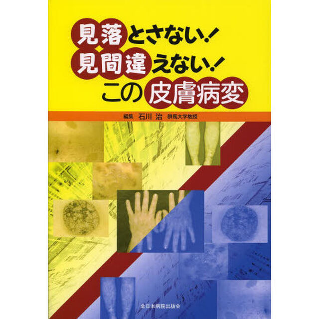 見落とさない！見間違えない！この皮膚病変