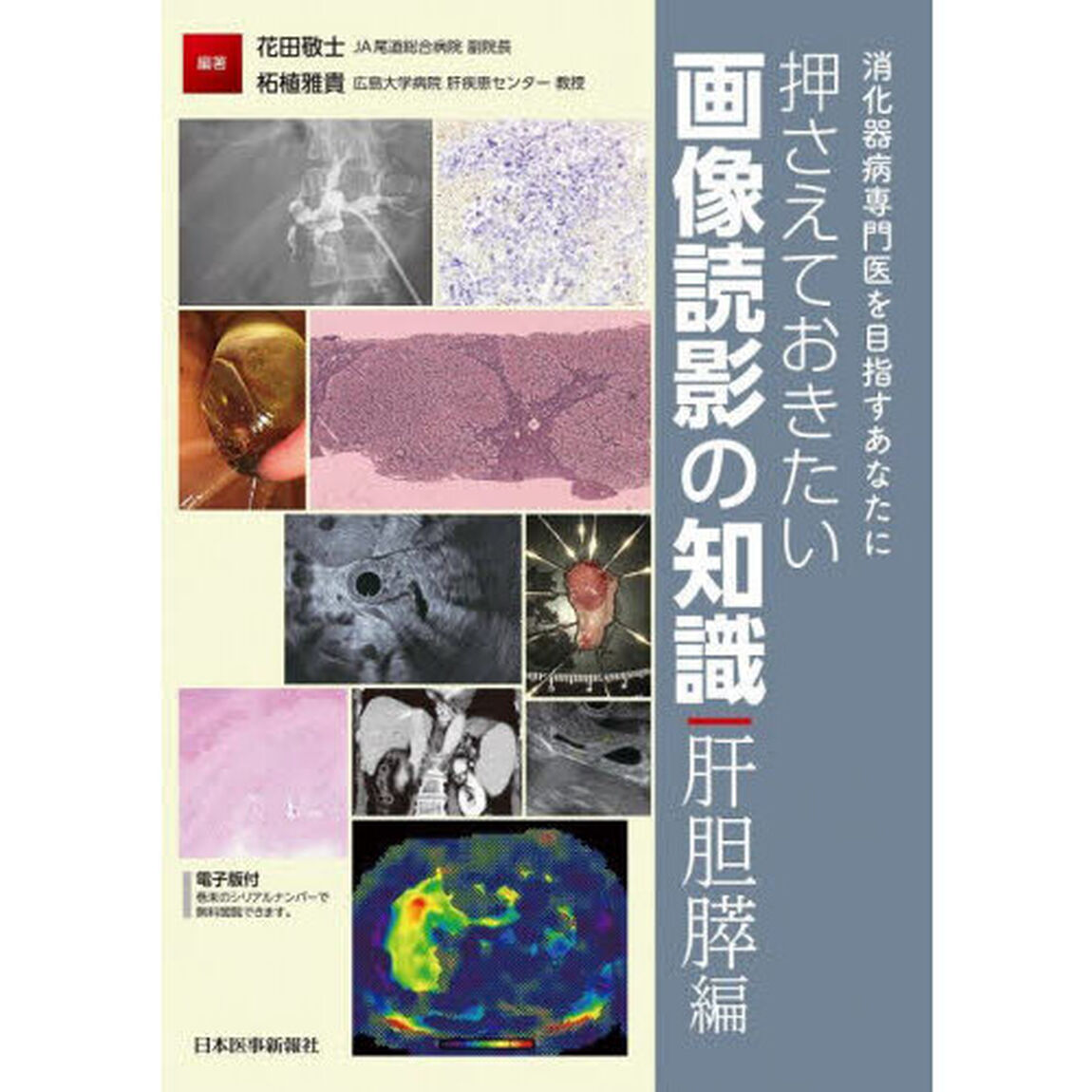 押さえておきたい画像読影の知識　消化器病専門医を目指すあなたに　肝胆膵編